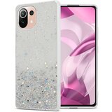 Cadorabo Xiaomi Mi 11 LITE (4G/5G)/11 LITE NE in prozorna z bleščicami - Zaščitni ovitek iz prožnega silikona TPU s svetlečimi bleščicami, (20860186) | Shoptok.si