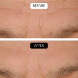 Cocunat Clinical Beauty Filler set proti staranju kože | Shoptok.si