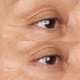 Perricone MD Hypoallergenic Clean Correction vlažilna in posvetlitvena nega za veke in kolobarje pod očmi 15 ml | Shoptok.si
