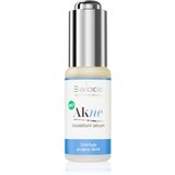 Saloos AcNO umirujući serum za problematično lice, akne 20 ml Cijene