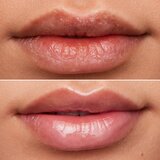 WONDERSKIN Lip Rehab Therapy Oil olje za ustnice z vlažilnim učinkom odtenek Clear 3,57 ml | Shoptok.si