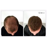Uvi Hair vlakna za kosu, MEDIUM BROWN / Srednje smeđa (velika 27,5 g, do 50 nanosa) | shoptok.hr