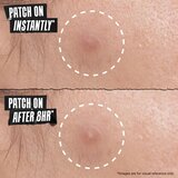 Kiehl's Truly Targeted Overnight Blemish Patch obliži za problematično kožo za ženske 22 kos | Shoptok.si