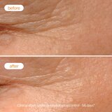 Novexpert Piling Noćna Krema sa Vitaminom C – Obnova i Blistav Ten Tokom Noći | Eponuda.com