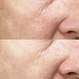 Darphin Intral Inner Youth Rescue Serum pomirjajoči serum za občutljivo kožo 30 ml | Shoptok.si