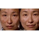 Omorovicza Elixir eliksir za prehrano in revitalizacijo kože 30 ml | Shoptok.si