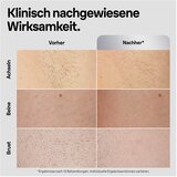 Braun Silk-expert Pro IPL PL5145 dlak | Shoptok.si