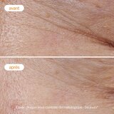 Novexpert Lagana Krema sa Vitaminom C – Hidratacija, Sjaj i Anti-Age Nega | Eponuda.com