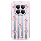  Futrola ultra tanki print clear za xiaomi redmi note 15 pro 5g sp006 ( F124936 ) | Eponuda.com