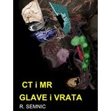 Donvas Robert Semnic
 - CT i MR glave i vrata | ePonuda.com
