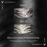 Vichy Dercos Anti-Dandruff šampon protiv peruti za suhu kosu 390 ml | shoptok.hr