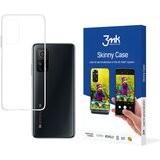 3mk Skinny futrola za Xiaomi Mi 10T/Mi 10T Pro - Prozirna | shoptok.hr