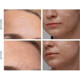 Foreo KIWI™ Derma uređaj za dijamantnu mikrodermoabraziju i čišćenje pora 1 kom | shoptok.hr