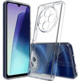 NN-Su Maska za Redmi 14C 4G, Transparent – TPU Phone Case Redmi 14C 4G | Eponuda.ba