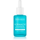 Dermedic Serum protiv nepravilnosti Normacne, 30 ml Cene