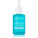 Serum protiv nepravilnosti Normacne, 30 ml