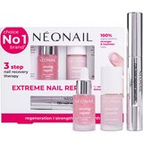 NeoNail Nail Care Set Extreme Nail Repair set(za nohte in obnohtno kožo) | Shoptok.si