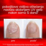 Essie to the rescue nega za nokte | ePonuda.com