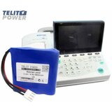  Baterijski paket 14.4V 2900mAh za EKG/ECG MAC 3 – LG INR18650-M29 ćelije | Eponuda.com