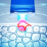 Foreo ESPADA™ 2 pero z modro lučko za pomirjenje pojava aken Cobalt Blue 1 kos | Shoptok.si