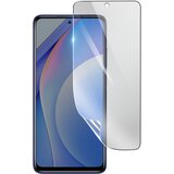3mk hidrogelna zaš?ita zaslona pred udarci za xiaomi mi 10T lite, prozorno, (21154063) | Shoptok.si