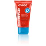 EVREE MAX REPAIR - Regenerativni serum za stopala 50ml cijene