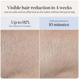 Smoothskin Pure Mini Lite IPL epilator PURE MINI LITE epil | Eponuda.com