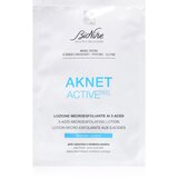 BioNike Aknet ACTIVEpeel eksfoliacijski robčki za obraz 20 kos | Shoptok.si