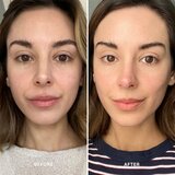 Alpha-H Vitamin C serum za osvetljevanje z vitaminom C 25 ml | Shoptok.si