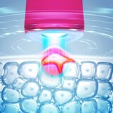 Foreo ESPADA™ 2 olovka za tretman akni s plavim svjetlom Fuchsia 1 kom | shoptok.hr