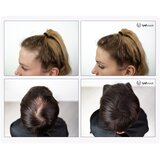 Uvi Hair lasna vlakna, MEDIUM BROWN / Srednje rjava (veliki 27.5 g, do 50 nanosov) | Shoptok.si