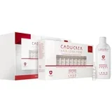 Hair Loss HSSC Serious Hair Loss lasni tretma za ženske proti močnemu izpadanju las ugodno pakiranje