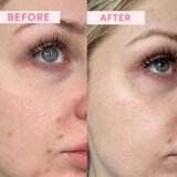 Sand & Sky Australian Emu Apple Resurfacing Mask gladilna maska za obnovo površine kože 60 g | Shoptok.si