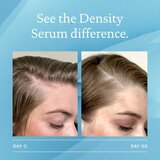 Living Proof Scalp Care serum za obnovitev gostote las 50 ml | Shoptok.si
