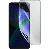 3mk hidrogelna zaš?ita zaslona pred udarci za tcl 20R 5G, prozorno, (21154391) | Shoptok.si