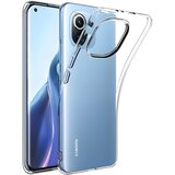 IZMAEL.eu Prozorno zaščitno ohišje za Xiaomi Mi 11 - Prozorna | Shoptok.si