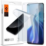 Spigen Neo Flex film za Xiaomi MI 11 / MI 11 Ultra 2 kom Cijene