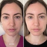 Alpha-H Vitamin B serum 25 ml | Shoptok.si