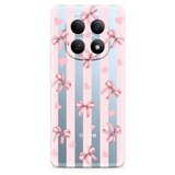  Futrola ultra tanki print clear za xiaomi redmi note 15 5g sp006 ( F124931 ) | Eponuda.com
