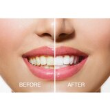 Rio USB teeth whitening set za izbjeljivanje zubi | shoptok.hr