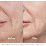 Silkn FaceTite Essential naprava za glajenje in odpravo gub | Shoptok.si