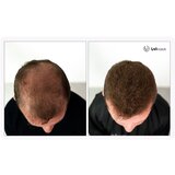 Uvi Hair vlakna za kosu, LIGHT BLONDE / Svijetloplava (velika 27,5 g, do 50 nanosa) | shoptok.hr