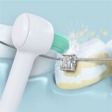  WEW 0984 W 303 Orthodontische Düse - zamjenska mlaznica | shoptok.hr