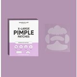 My White Secret Breakout + Aid X-Large Pimple Patches lokalna nega proti aknam s salicilno kislino 5 kos | Shoptok.si