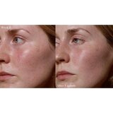 Omorovicza Elixir eliksir za prehrano in revitalizacijo kože 30 ml | Shoptok.si