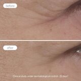 Novexpert Expert Anti-Aging krema za zonu oko očiju – Protiv bora, podočnjaka i otečenosti | Eponuda.com