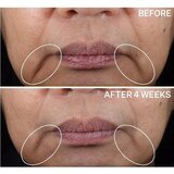 StriVectin Contour Restore™ Tightening & Sculpting Face Cream ultra lifting krema za obraz 50 ml | Shoptok.si