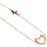 Vuch Glimmer Rose Gold Bracelet | ePonuda.com