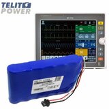 Telit Power baterija li-ion 11.1v 5800mah lg( p-2397 ) za bitos bt-740 pacijent monitor u