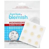  Flasteri s mikroiglicama protiv akni Bye Bye Blemish – 9 kom Cijene